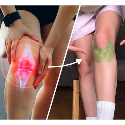 Knee Relief Patch Set  Herbal-infused Adhesive Patches (10 Pc Set)